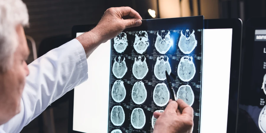 Types de maux de tête et comment obtenir un diagnostic - trauma headache