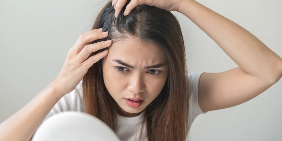 Remedios naturales para la caspa - image